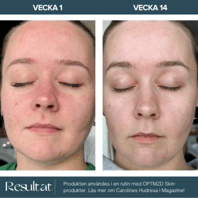 Optmzd.Skin Calming Hydrating Serum