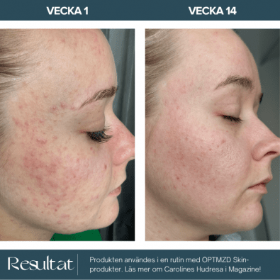 Optmzd.Skin Retinol + Ferulic Night Cream