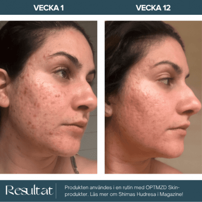 Optmzd.Skin Blemish and Protect Day Cream SPF30