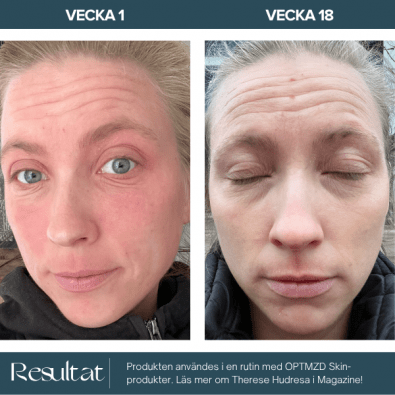 Optmzd.Skin Redness Control Night Cream