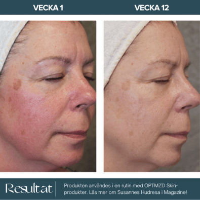 Optmzd.Skin Vitamin C Anti-Pigment Serum