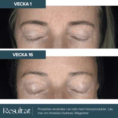 Verso Super Eye Serum