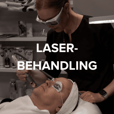 LASER/IPL Behandling