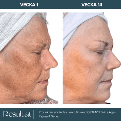 Optmzd.Skin Vitamin C Anti-Pigment Serum