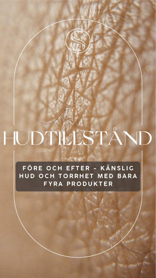 Minska känslig hud och torrhet - före och efter