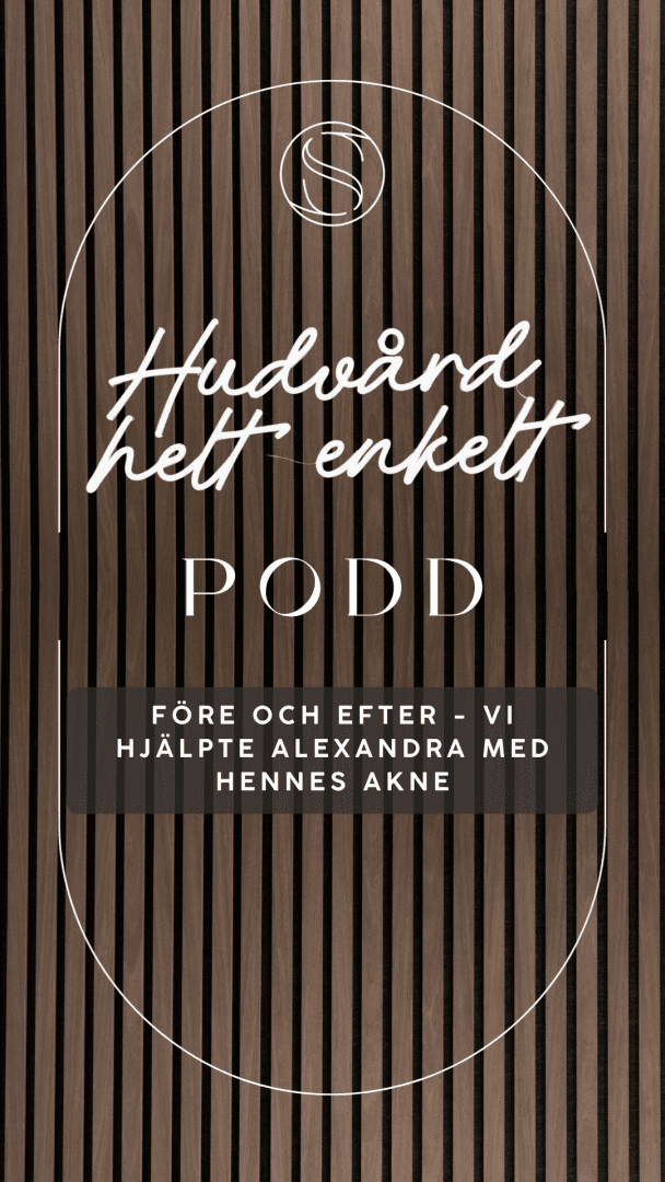 Före och efter - Alexandras akne minskade med OPTMZD Skin